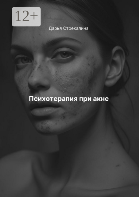 Психотерапия при акне