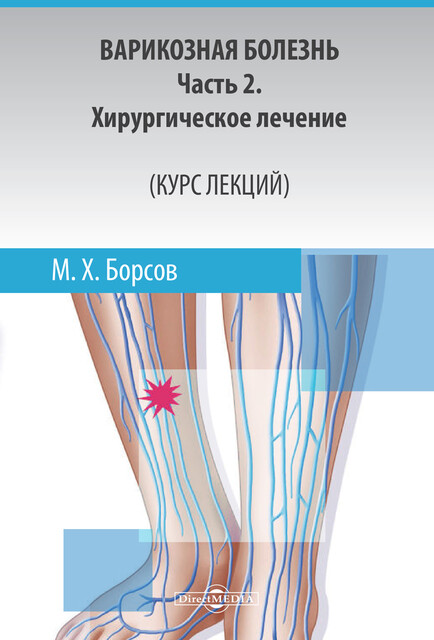 Варикозная болезнь