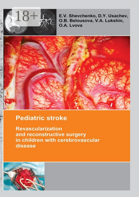 Pediatric stroke. Revascularization and reconstructive surgery in children with cerebrovascular disease