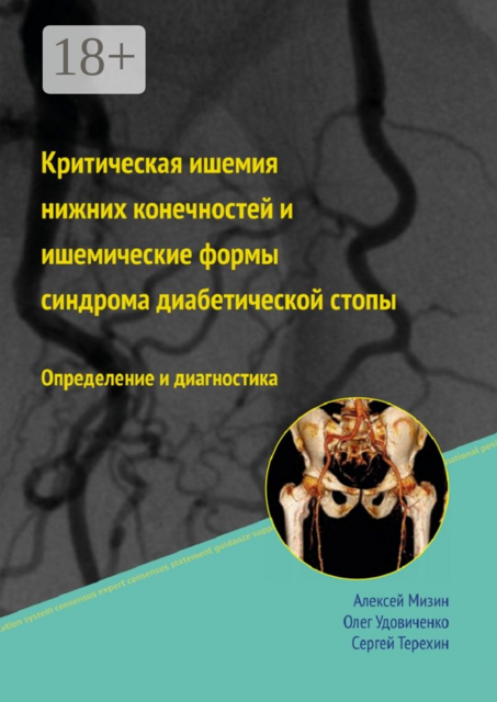 Критическая ишемия нижних конечностей и ишемические формы синдрома диабетической стопы, Мизин Алексей, Терёхин Сергей, Удовиченко Олег
