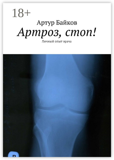 Артроз, стоп!. Личный опыт врача, Артур Байков