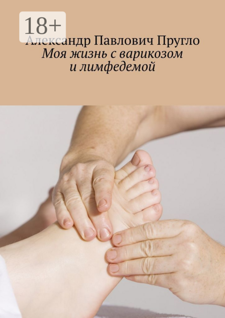 Моя жизнь с варикозом и лимфедемой, Александр Пругло