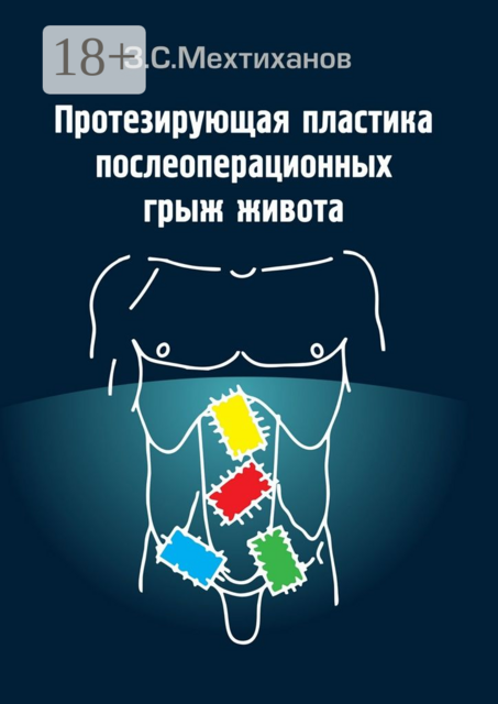 Протезирующая пластика послеоперационных грыж живота, Зубаир Мехтиханов