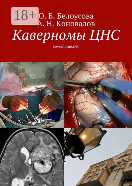 Каверномы ЦНС. cavernoma.net, А.Н. Коновалов, О.Б. Белоусова