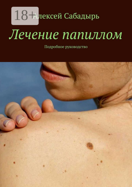 Лечение папиллом. Подробное руководство, Алексей Сабадырь
