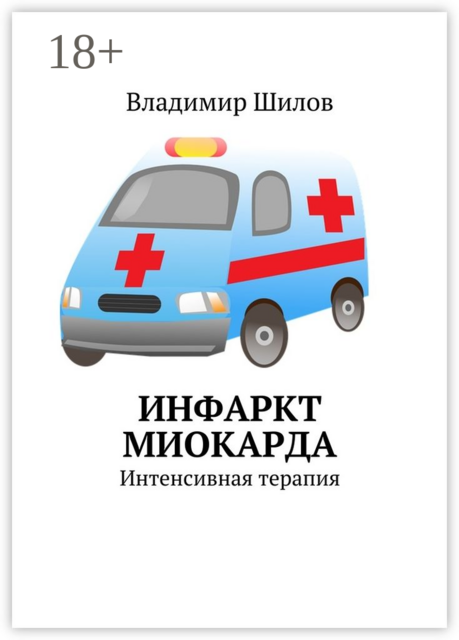 Инфаркт миокарда. Интенсивная терапия