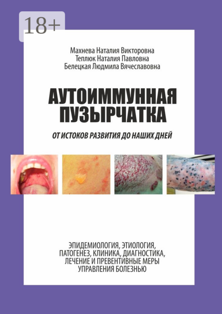 Аутоиммунная пузырчатка. От истоков развития до наших дней, Людмила Белецкая, Наталия Махнева, Наталия Теплюк
