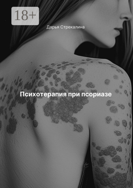 Психотерапия при псориазе