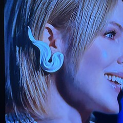 Живая кингуруха