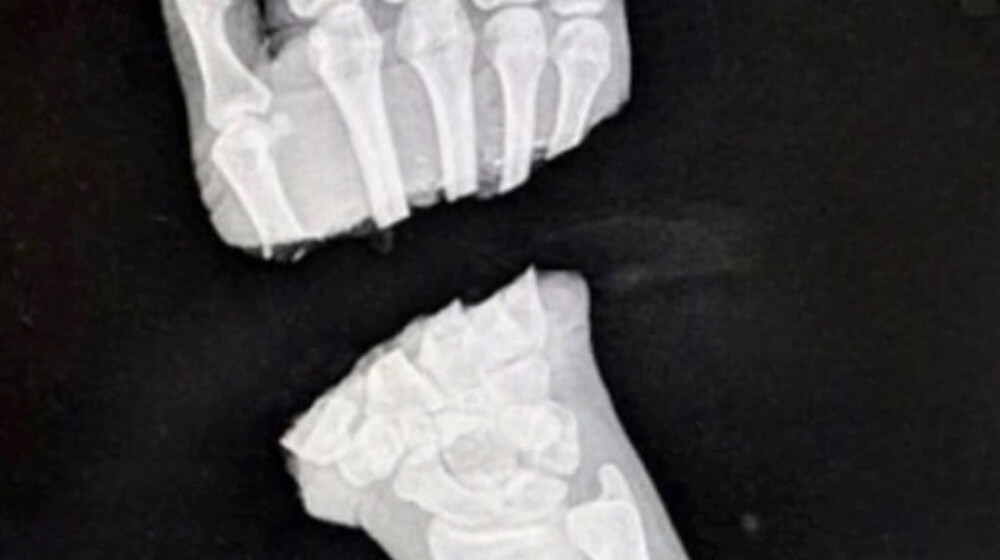 ИЗЛ Реализм