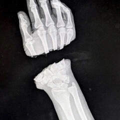 ИЗЛ Реализм