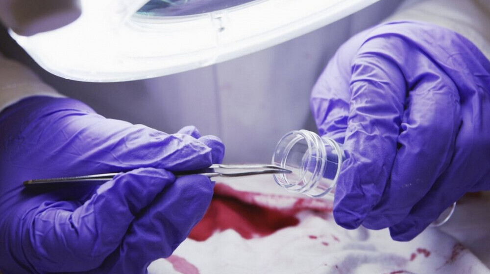 Судмедэкспертиза 