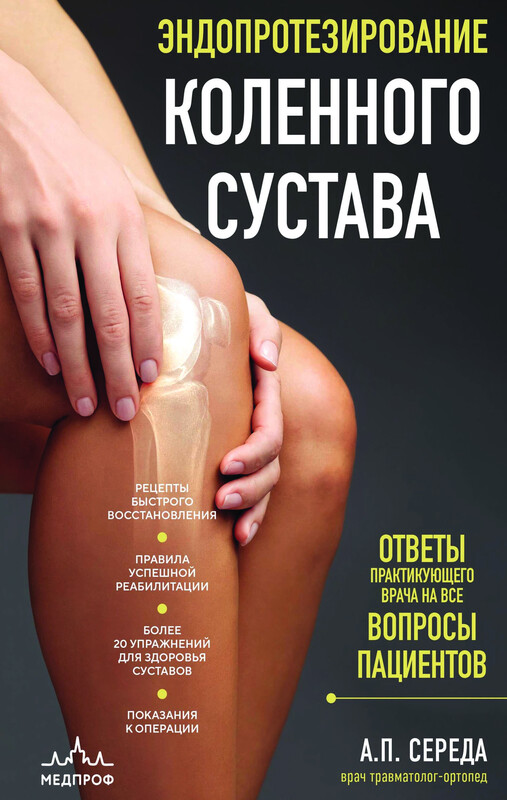 Эндопротезирование коленного сустава: ответы практикующего врача на все вопросы пациентов, Андрей Середа