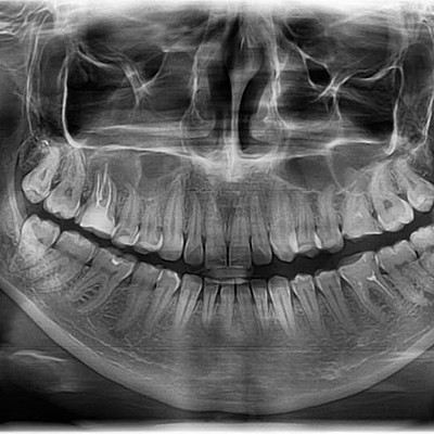 Игорь Егоров